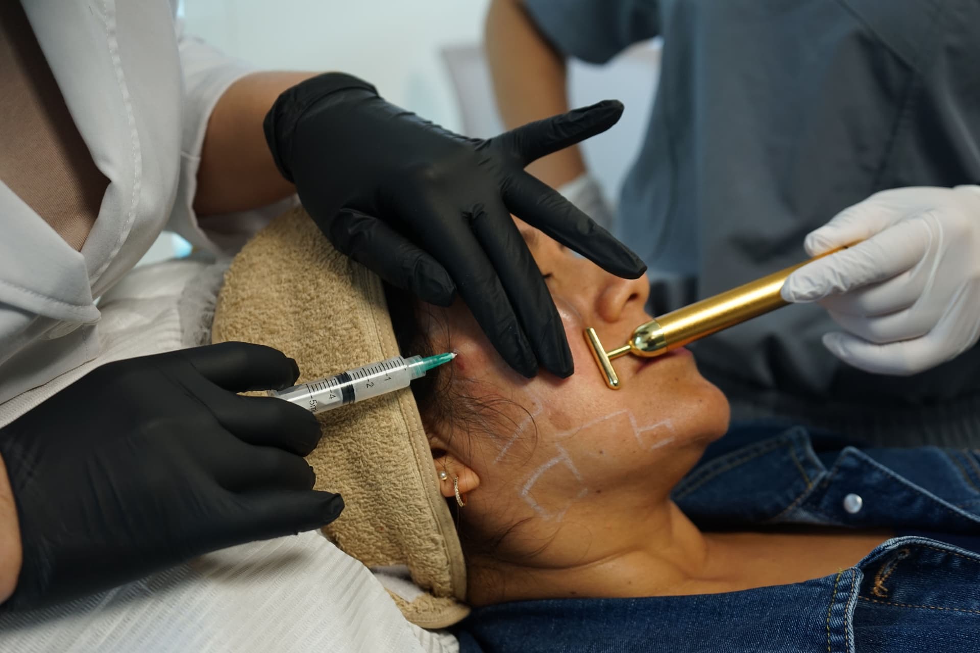 Bioestimuladores de Colágeno — Cuidamedic